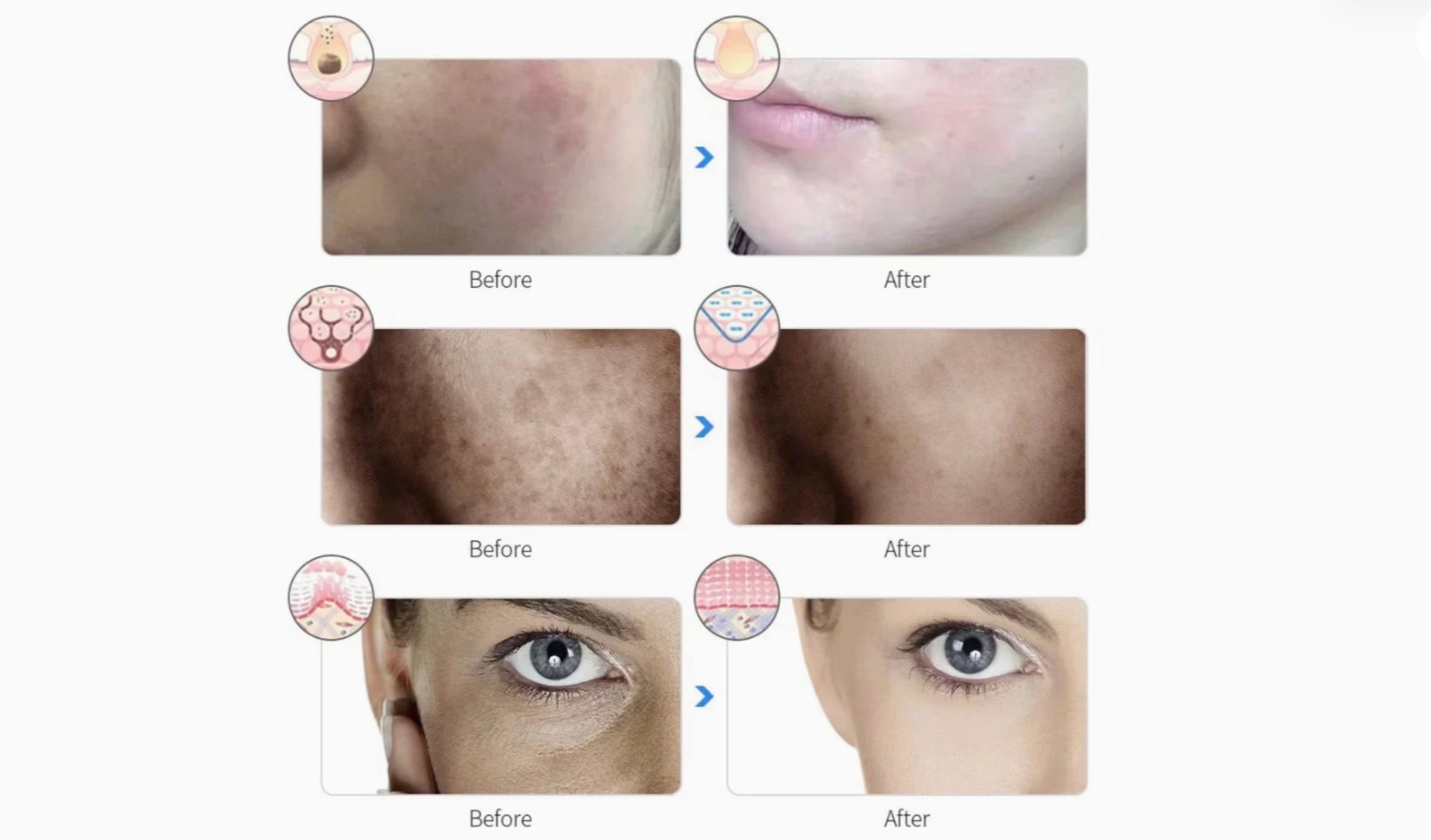 Clinical LED Face Therapy Mask