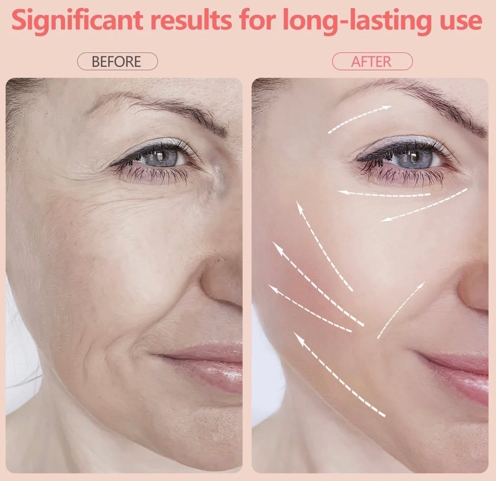 LED Face and Neck Sculptor